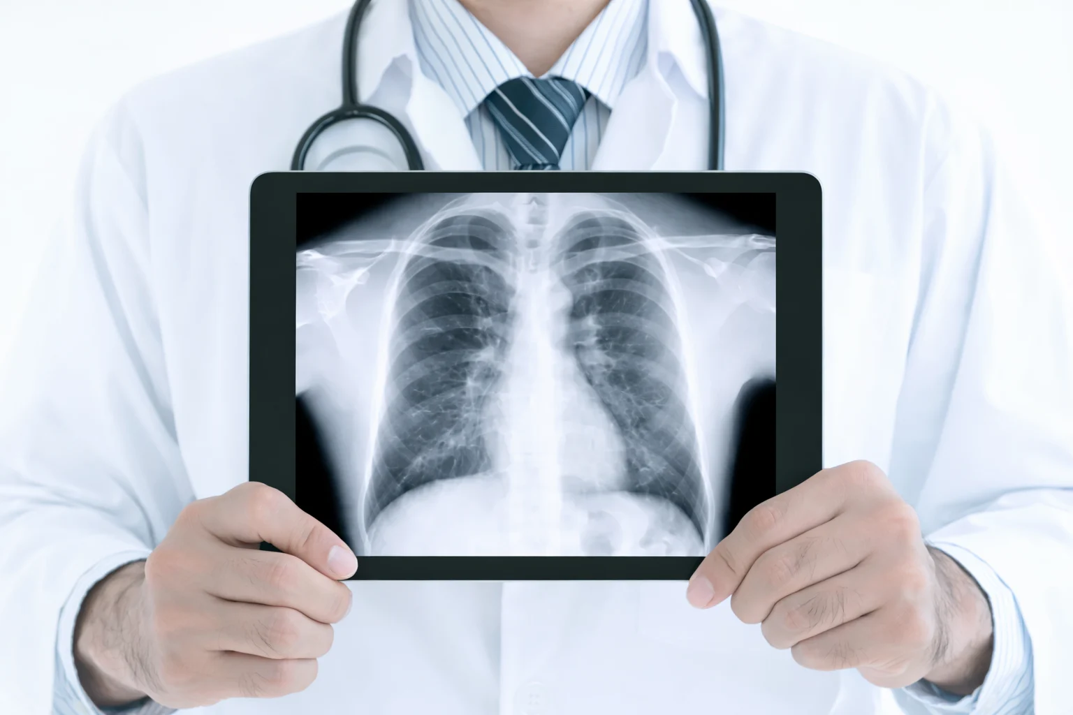 X-Ray at Home – NowCare24